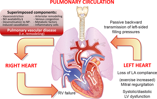 Heart Failure | European Heart Journal | Oxford Academic